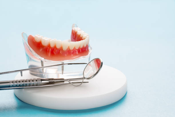 Dental Inlays and Onlays in Erwin, NC